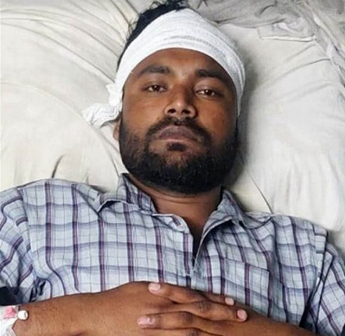 শিবির কর্মীকে পিটিয়ে আহত করার অভিযোগ বিএনপির বিরুদ্ধে