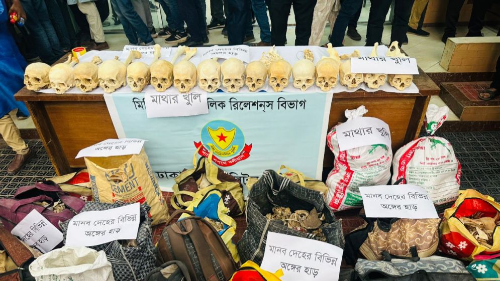 কঙ্কাল চুরির নেপথ্যে মেডিকেল শিক্ষার্থী ও সংঘবদ্ধ চক্র